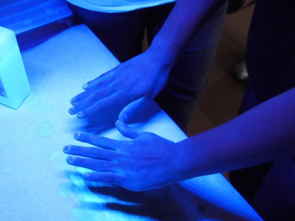 Freie Stellen an den Händen, sogenannte „Benetzungslücken“ werden unter UV-Licht sichtbar